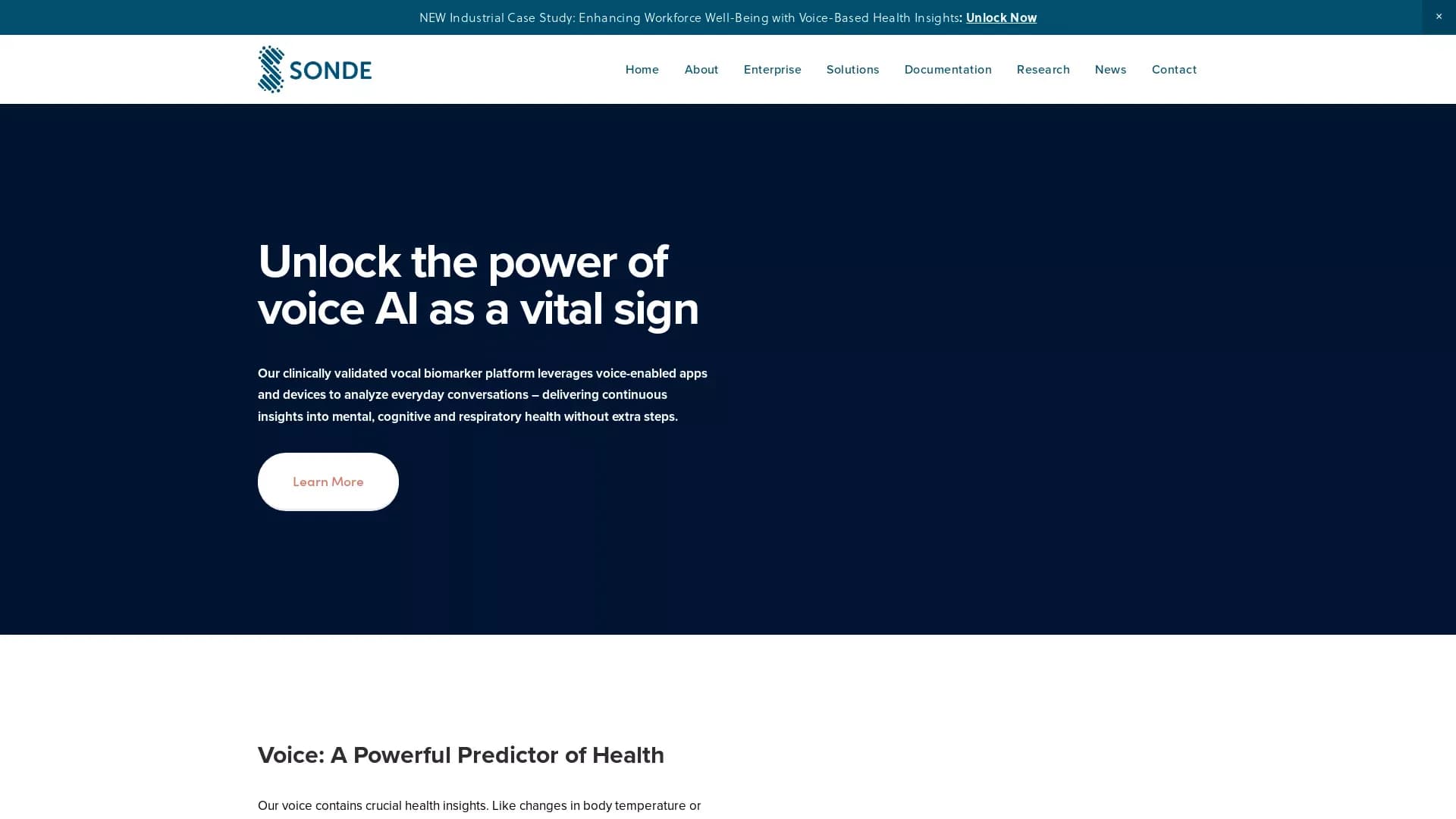 Sonde Health