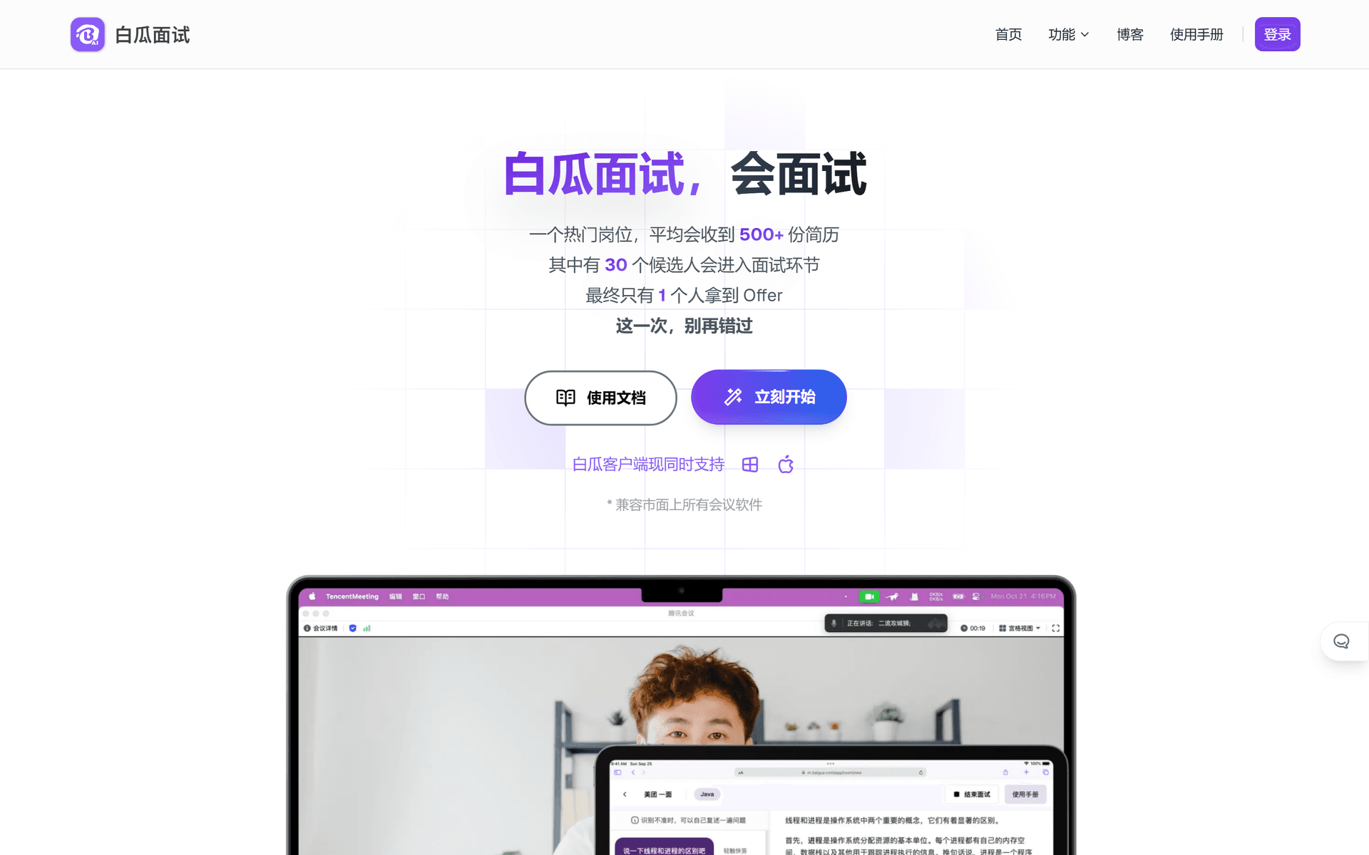 白瓜面试